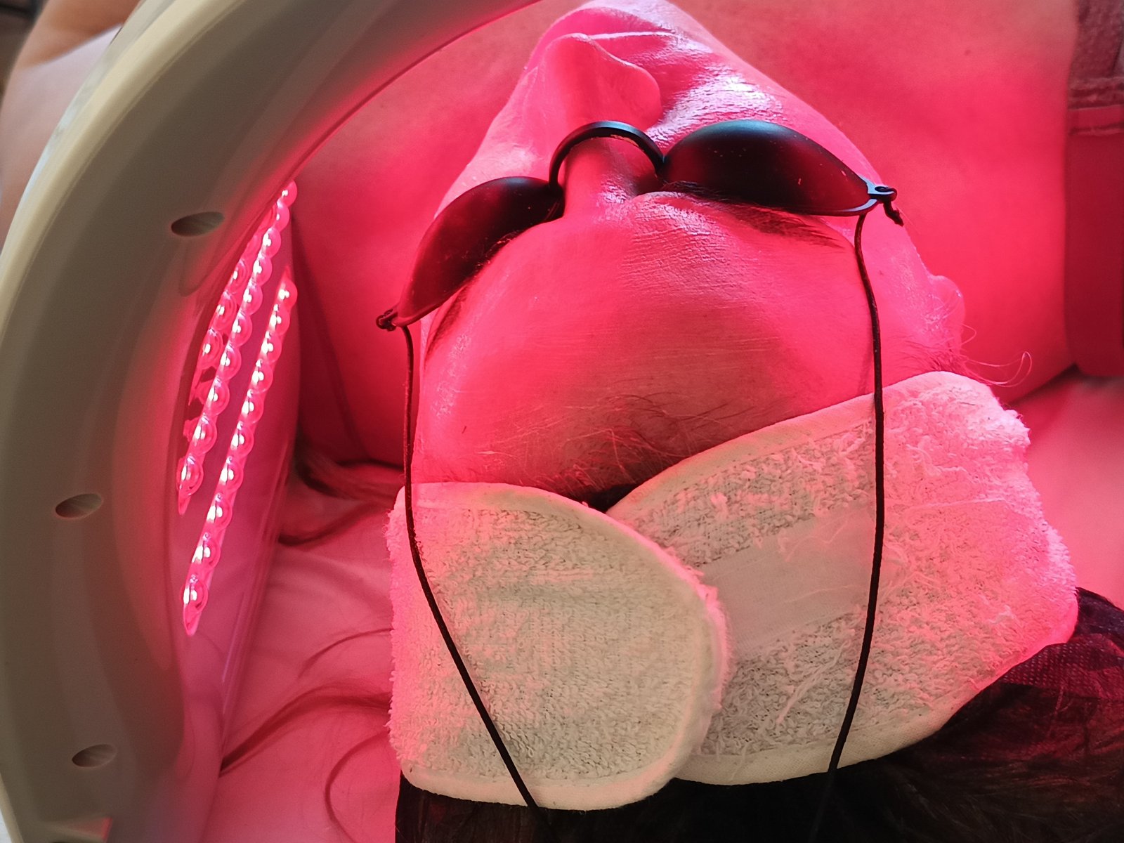 Protocolo Rejuvenecimiento facial