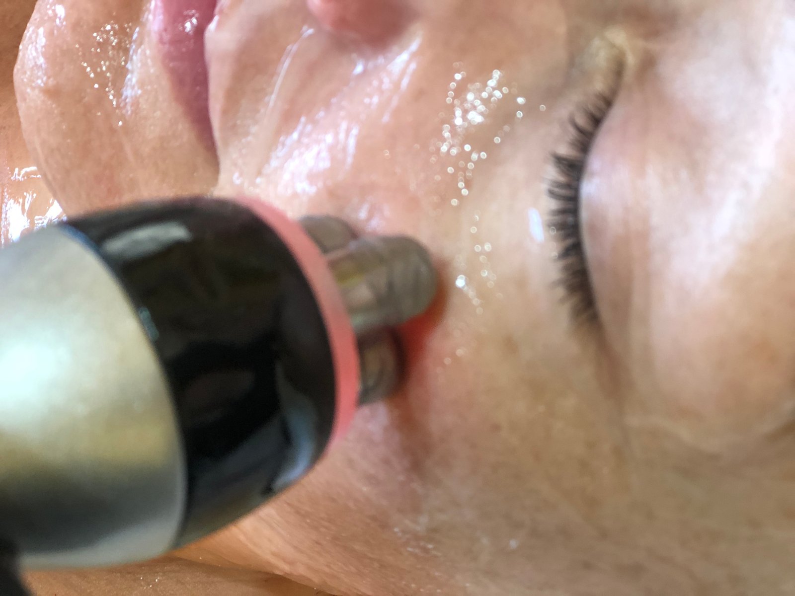 Protocolo Reafirmante facial